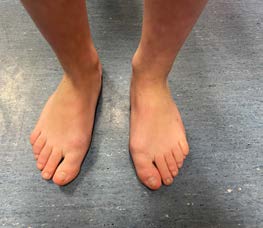 chir_hallux_3.jpg