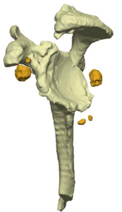 Chir_Prothese_3.jpg Chir_Prothese_3.jpg