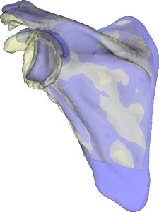 Chir_Prothese_4.jpg Chir_Prothese_4.jpg