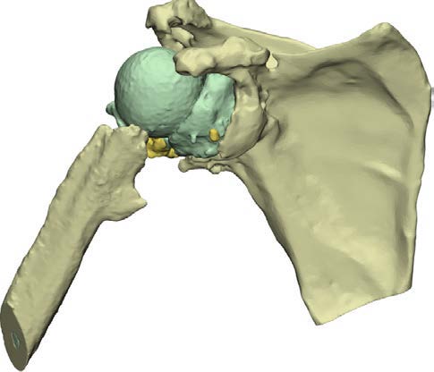 Chir_Prothese_6.jpg Chir_Prothese_6.jpg