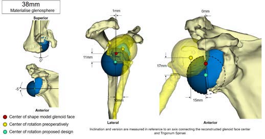 Chir_Prothese_7.jpg Chir_Prothese_7.jpg
