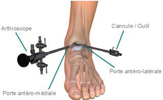Chir_Arthroscopie_2.jpg Chir_Arthroscopie_2.jpg