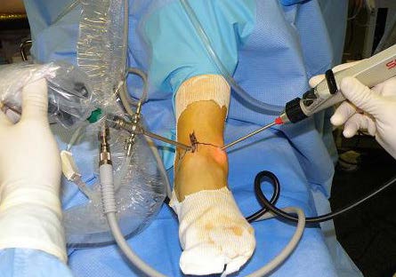 Chir_Arthroscopie_3.jpg Chir_Arthroscopie_3.jpg