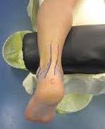 Chir_Arthroscopie_3B.jpg Chir_Arthroscopie_3B.jpg