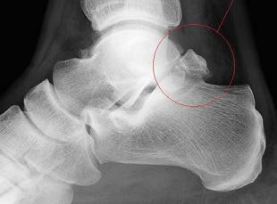 Chir_Arthroscopie_8.jpg Chir_Arthroscopie_8.jpg