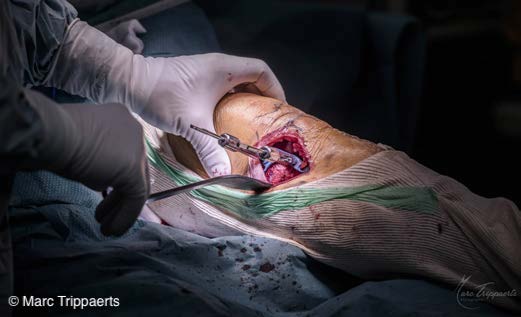 Chir_osteotomie_5.jpg Chir_osteotomie_5.jpg