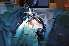 Deep-Brain-Stimulation.jpg