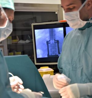 stimulation-cordonale-posterieure